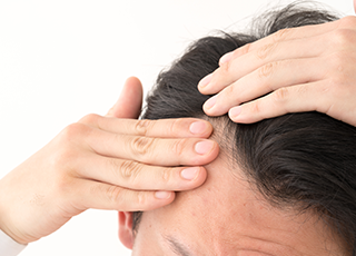 男性型脱毛症（AGA）