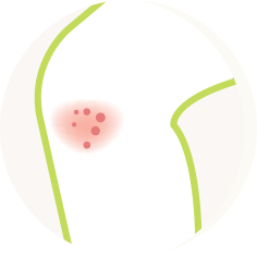 かゆみアイコン