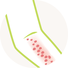 アトピーアイコン